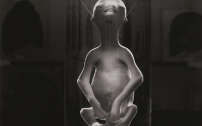 EL FETO CON EL QUE COMPARTÍ MI INFANCIA